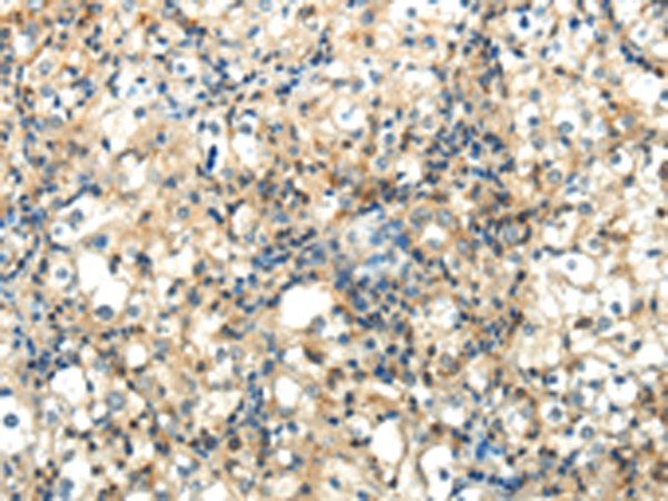 Rabbit Polyclonal Antibody to WNT2