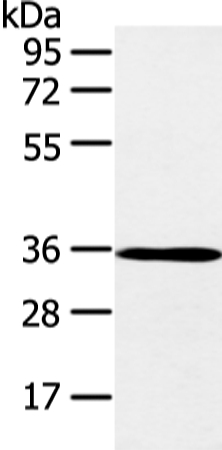 E2F5