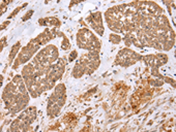 Rabbit Polyclonal Antibody to E2F5