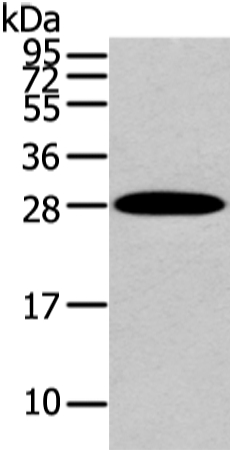 ZNF365