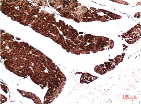 Muscle actin