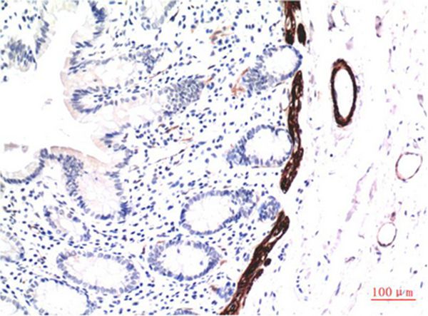 Mouse Monoclonal Antibody to Muscle actin