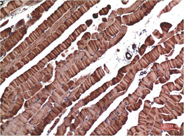 Mouse Monoclonal Antibody to Muscle actin