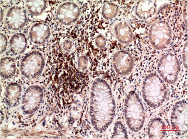 Epsilon Tubulin Mouse(3G1)
