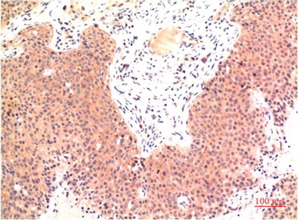 Mouse Monoclonal Antibody to Epsilon Tubulin
