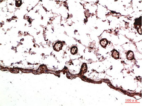 Mouse Monoclonal Antibody to PDGFRα