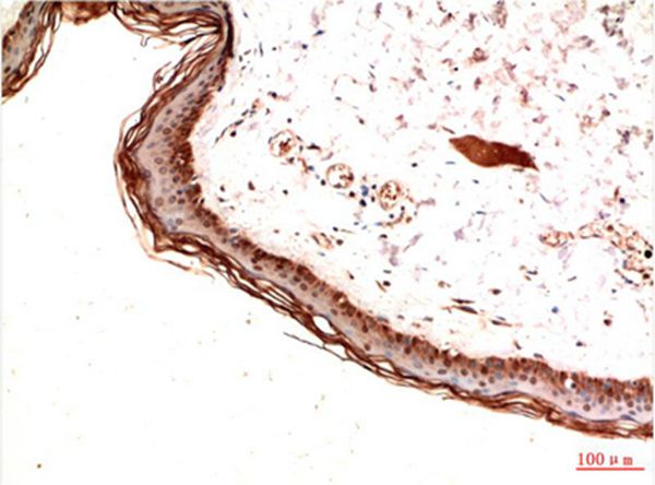 Mouse Monoclonal Antibody to PDGFRα