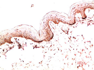 Mouse Monoclonal Antibody to Collagen I