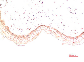 Mouse Monoclonal Antibody to Collagen I