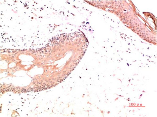 Mouse Monoclonal Antibody to Collagen I