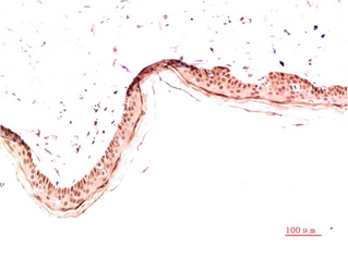 Mouse Monoclonal Antibody to Collagen I
