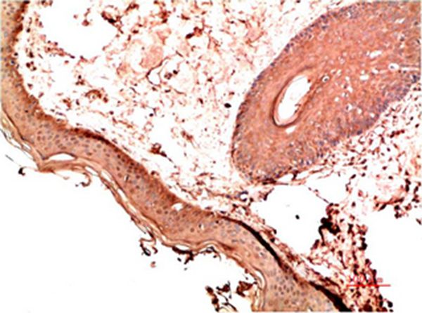 Mouse Monoclonal Antibody to Collagen I