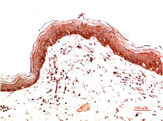 Mouse Monoclonal Antibody to Collagen I