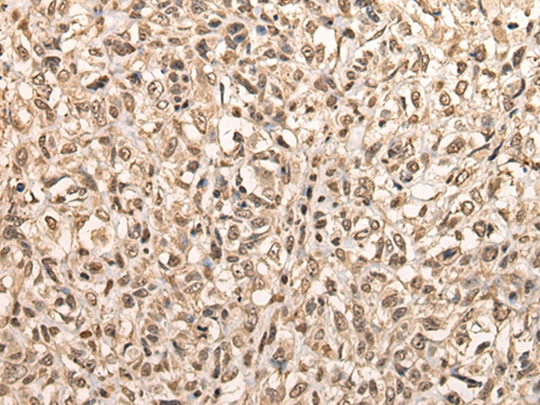 Rabbit Polyclonal Antibody to BARX1