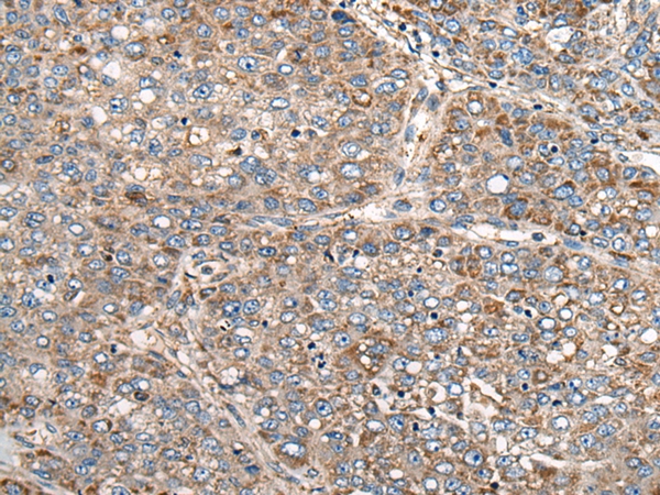 Rabbit Polyclonal Antibody to CADM2