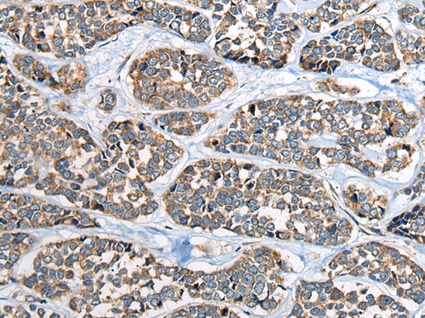Rabbit Polyclonal Antibody to CADM2