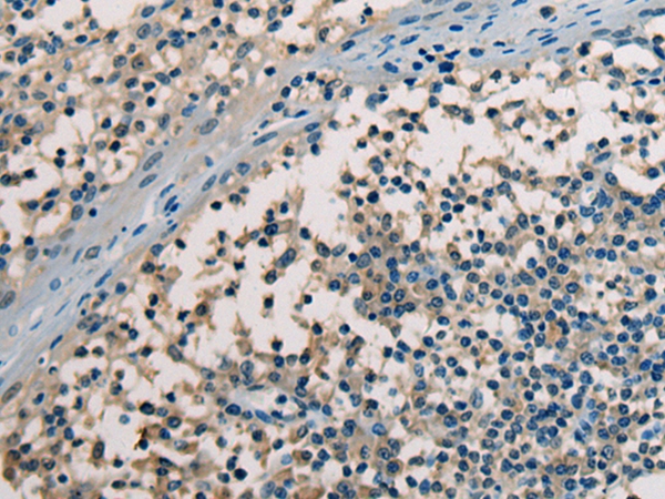 Rabbit Polyclonal Antibody to CHODL