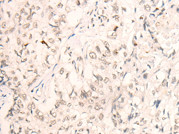 Rabbit Polyclonal Antibody to KLF2