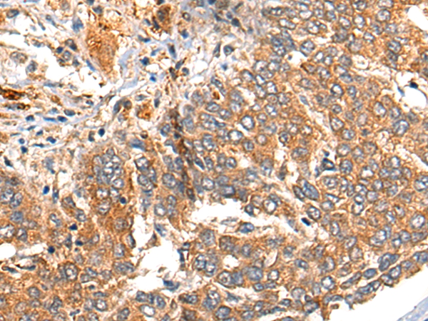 Rabbit Polyclonal Antibody to MARK2