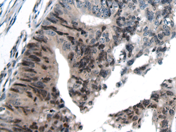 Rabbit Polyclonal Antibody to THRA/THRB