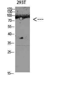 CD168