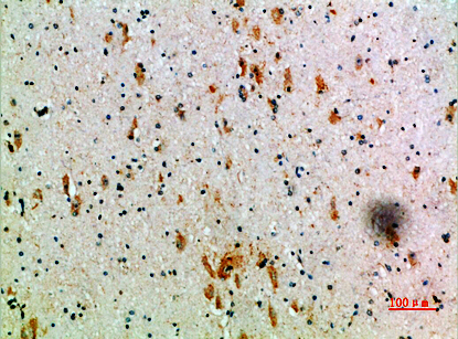 CD158k