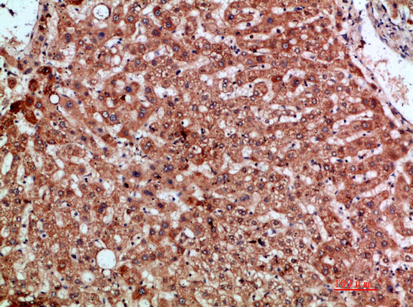 MIP-3α