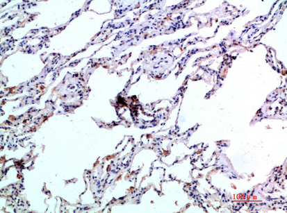 Eotaxin-2