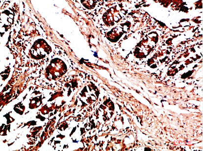 HLA-DQA1