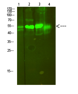 V-ATPase S1