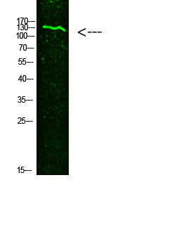 COL19A1