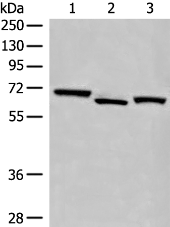 EEPD1