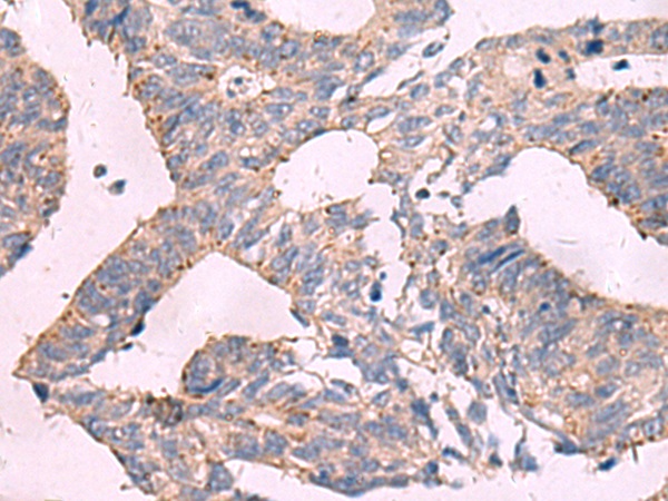 Rabbit Polyclonal Antibody to KCNU1