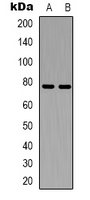 CEP78