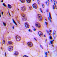 Rabbit Polyclonal Antibody to MRPL41