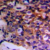 Rabbit Polyclonal Antibody to MTIF3