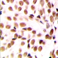 Rabbit Polyclonal Antibody to NFYB