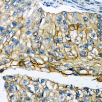 Rabbit Polyclonal Antibody to POTEG