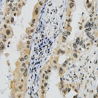 Rabbit Polyclonal Antibody to SUPT16H