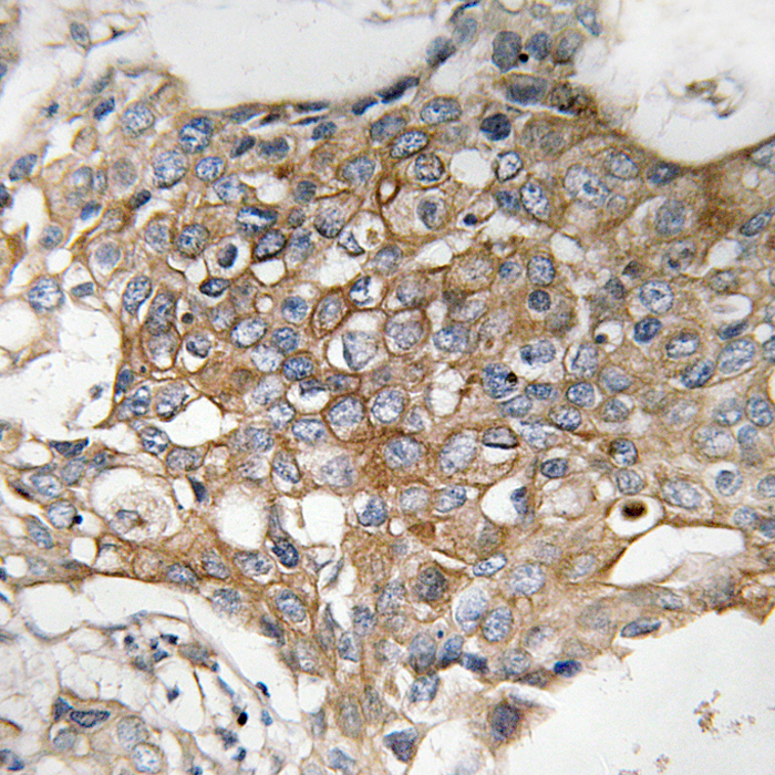 Rabbit Polyclonal Antibody to FAM11A