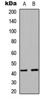RAD51C