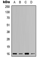 RPL37A