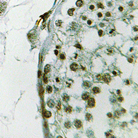 Rabbit Polyclonal Antibody to Ubiquilin 3