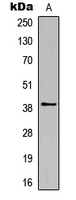 Rhodopsin