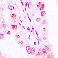 Rabbit Polyclonal Antibody to SAP49