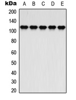 ATP1A2