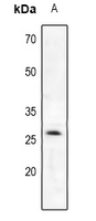 Trypsin 2