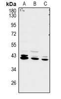 RCL1