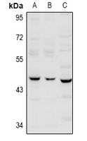 Serpin B12