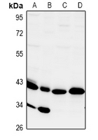 CD172g